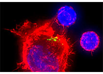 Nat Biomed Engin：重大突破！科学家利用纳米颗粒开发出可快速准确进行癌症诊断的新技术