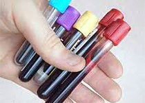 Science：重磅！一种血液测试方法可同时筛选8种癌症