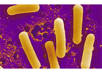Cell Host & Micro：对于机体健康而言 肠道菌群或许扮演着“双面角色”