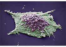 将人类癌细胞移入小鼠体内（PDX）改变肿瘤进化