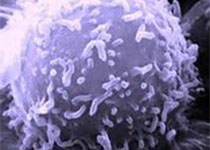 科学家们揭示恶性乳腺癌患者体内肿瘤的进化时间轴