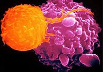 《柳叶刀》警告人类里程碑免疫疗法抗PD1的严重致命并发症，死亡率高达46%！